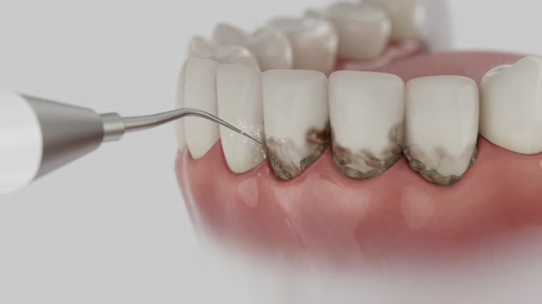 Reliable Emergency Dentist contractor in Valley View, OH by Smile Center Dentistry